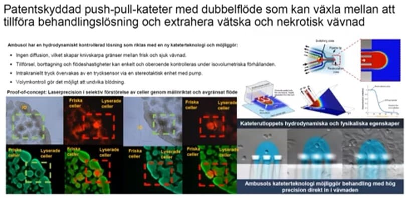 Ambusol, medicinteknik mot Glioblastoma Multiforme (GBM)