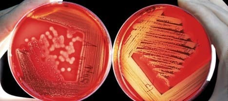 Abera Bioscience IPO får teckna-rekommendation av Affärsvärlden