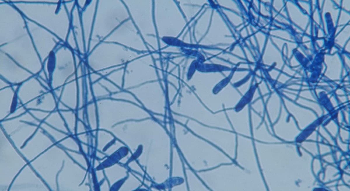 Moberg Pharma ska dra tillbaka emissionsbemyndigande, är välkapitaliserat