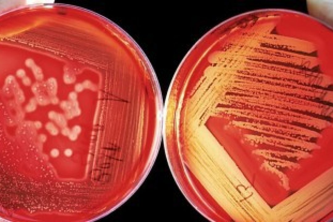 Abera Bioscience IPO får teckna-rekommendation av Affärsvärlden