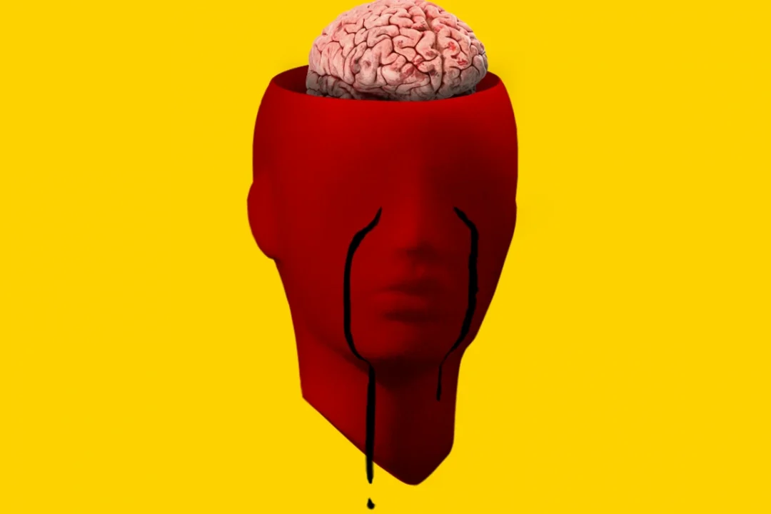 Ledsen hjärna över vad som händer i Braincool